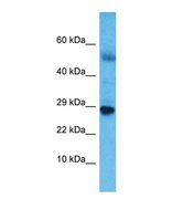 Western blot of Human Esophagus Tumor. NKX6-3 antibody dilution 1.0 ug/ml.