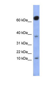 NKX6-3 antibody LS-C110456 Western blot of Fetal Small Intestine lysate.