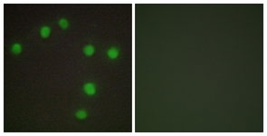 Immunofluorescence of HUVEC cells, using NKX6.3 Antibody. The picture on the right is treated with the synthesized peptide.