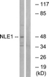 Western blot of extracts from COS cells, using NLE1 Antibody. The lane on the right is treated with the synthesized peptide.