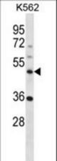 NLE1 Antibody western blot of K562 cell line lysates (35 ug/lane). The NLE1 antibody detected the NLE1 protein (arrow).