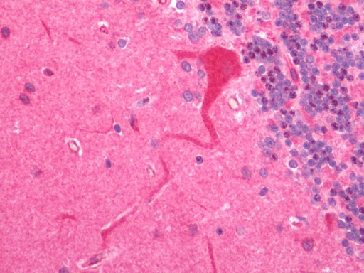 Human Brain, Cerebellum: Formalin-Fixed, Paraffin-Embedded (FFPE) 