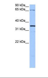 Hela cell lysate. Antibody concentration: 1.0 ug/ml. Gel concentration: 12%.