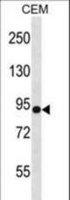 NLGN4Y Antibody western blot of CEM cell line lysates (35 ug/lane). The NLGN4Y antibody detected the NLGN4Y protein (arrow).