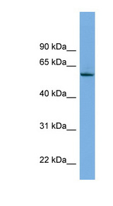NLK antibody LS-C117249 Western blot of 293T cell lysate.