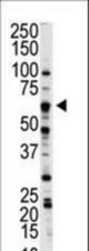 Western blot of anti-NLK antibody in A375 cell lysate. NLK (arrow) was detected using purified antibody. Secondary HRP-anti-rabbit was used for signal visualization with chemiluminescence.