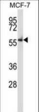 Mouse Nlk Antibody western blot of MCF-7 cell line lysates (35 ug/lane). The Nlk antibody detected the Nlk protein (arrow).
