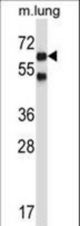 Mouse Nlk Antibody western blot of mouse lung tissue lysates (35 ug/lane). The Nlk antibody detected the Nlk protein (arrow).