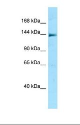 Western blot of Human Jurkat . NLRC5 antibody dilution 1.0 ug/ml.