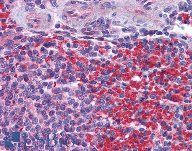 Anti-NLRC5 antibody IHC of human spleen. Immunohistochemistry of formalin-fixed, paraffin-embedded tissue after heat-induced antigen retrieval. Antibody LS-B5328 concentration 5 ug/ml.