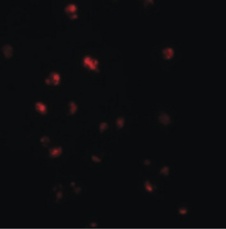 Immunofluorescence of NOD4 in HeLa cells with NOD4 antibody at 20 ug/ml.