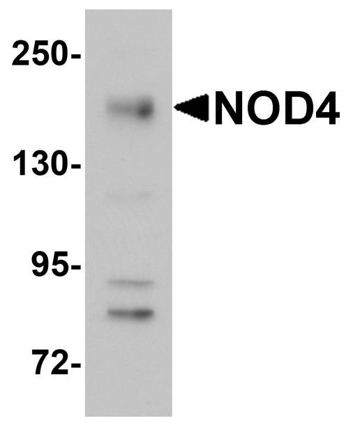 Western blot analysis of NOD4 in EL4 cell lysate with NOD4 antibody at 1 ug/ml.