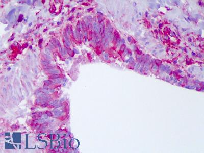 Anti-NLRP11 antibody IHC of human lung. Immunohistochemistry of formalin-fixed, paraffin-embedded tissue after heat-induced antigen retrieval. Antibody LS-B6192 concentration 5 ug/ml.