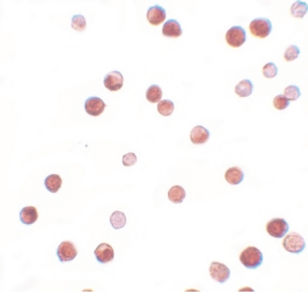 Immunocytochemistry of NALP11 in HeLa cells with NALP11 antibody at 2.5 ug/ml.