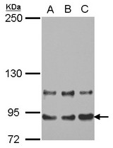 Sample (30 ug of whole cell lysate) A: A431 B: HeLa C: HepG2 5% SDS PAGE MED16 / THRAP5 antibody diluted at 1:1000