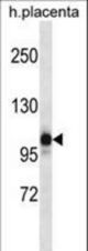 NLRP12 Antibody western blot of human placenta tissue lysates (35 ug/lane). The NLRP12 antibody detected the NLRP12 protein (arrow).