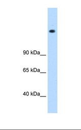 721_B cell lysate. Antibody concentration: 0.5 ug/ml. Gel concentration: 8%.