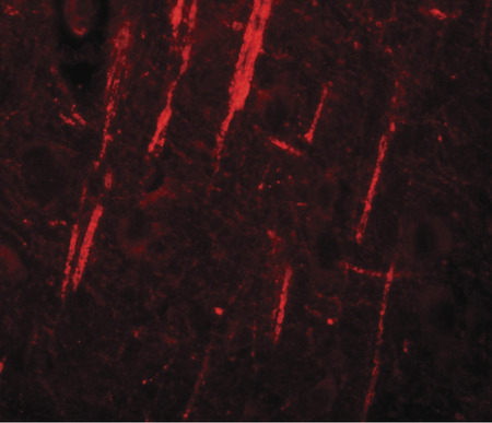 Immunofluorescence of NALP12 in human brain tissue with NALP12 antibody at 20 ug/ml.