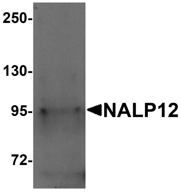 Western blot analysis of NALP12 in human brain tissue lysate with NALP12 antibody at 1 ug/ml.