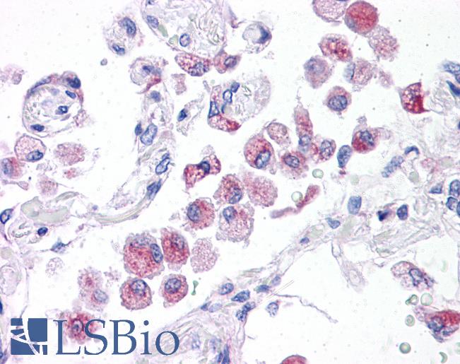 Anti-NLRP14 antibody IHC of human lung. Immunohistochemistry of formalin-fixed, paraffin-embedded tissue after heat-induced antigen retrieval. Antibody LS-B5338 concentration 5 ug/ml.