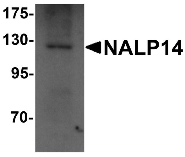 Western blot analysis of NALP14 in rat brain tissue lysate with NALP14 antibody at 1 ug/ml.