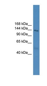 NLRP5 antibody LS-C135481 Western blot of Fetal Lung lysate.