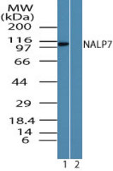 Western blot of NALP7 in human liver lysate in the 1) absence and 2) presence of immunizing peptide using LS-C148409 at 0.25 ug/ml. Goat anti-rabbit Ig HRP secondary antibody, and PicoTect ECL substrate solution, were used for this test.