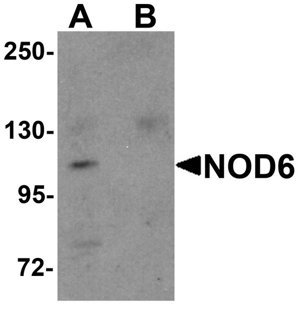 Western blot analysis of NOD6 in EL4 cell lysate with NOD6 antibody at 1 ug/ml in the (A) absence and (B) presence of blocking peptide.