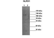 Western blot of mouse neuroblastoma tumor. Lane 1: 35 ug mouse neuroblastoma cells with empty vector. Lane 2: 35 ug mouse neuroblastoma cells with NLRX1 siRNA. NLRX1 Antibody Dilution 1:1000.