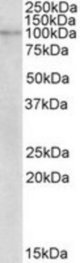 NLRX1 antibody (2 ug/ml) staining of Human Breast cancer lysate (35 ug protein/ml in RIPA buffer). Primary incubation was 1 hour. Detected by chemiluminescence.