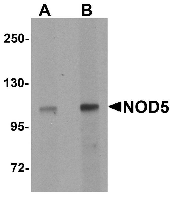 Western blot analysis of NOD5 in rat spleen tissue cell lysate with NOD5 antibody at (A) 1 and (B) 2 ug/ml.