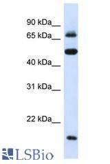 MED16 / THRAP5 antibody Western Blot of 293T. Antibody dilution: 1 ug/ml.