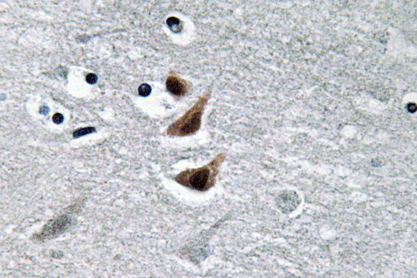 IHC of NM23-H1 (Y52) pAb in paraffin-embedded human brain tissue.
