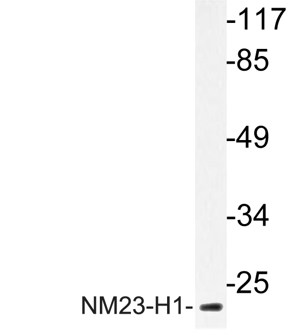 Western blot of NM23-H1 (Y52) pAb in extracts from HeLa cells.