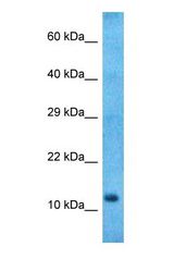 Western blot of NMB Antibody with human Stomach Tumor lysate.