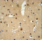 NMB Antibody immunohistochemistry of formalin-fixed and paraffin-embedded human brain tissue followed by peroxidase-conjugated secondary antibody and DAB staining.