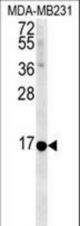 NMB Antibody western blot of MDA-MB231 cell line lysates (35 ug/lane). The NMB antibody detected the NMB protein (arrow).