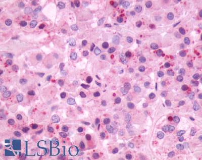 Anti-NMBR antibody LS-A828 IHC of human brain, pituitary. Immunohistochemistry of formalin-fixed, paraffin-embedded tissue after heat-induced antigen retrieval.