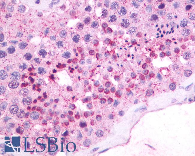 Anti-NMBR antibody IHC of human testis. Immunohistochemistry of formalin-fixed, paraffin-embedded tissue after heat-induced antigen retrieval. Antibody LS-A825 dilution 16 ug/ml.