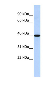 NMBR antibody LS-C102789 Western blot of Fetal Brain lysate.