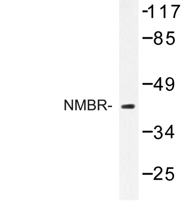 Western blot of NMBR (L264) pAb in extracts from 293 cells.