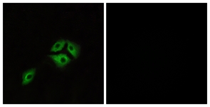 Immunofluorescence of A549 cells, using NMBR Antibody. The picture on the right is treated with the synthesized peptide.