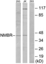 Western blot of extracts from 293/Jurkat cells, using NMBR Antibody. The lane on the right is treated with the synthesized peptide.