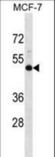 NMBR Antibody western blot of MCF-7 cell line lysates (35 ug/lane). The NMBR antibody detected the NMBR protein (arrow).
