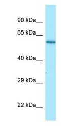 NMD3 antibody Western Blot of Fetal kidney.
