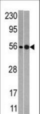 Western blot of anti-NMD3 antibody in mouse heart (left) and T47D (right)tissue lysates (35 ug/lane). NMD3(arrow) was detected using the purified antibody.