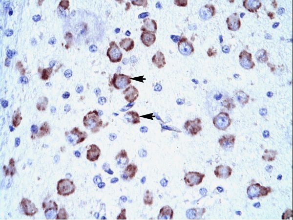 MED17 / TRAP80 antibody LS-C29825 was used in IHC to stain formalin-fixed, paraffin-embedded human brain.