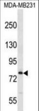 MED17 Antibody western blot of MDA-MB231 cell line lysates (35 ug/lane). The MED17 antibody detected the MED17 protein (arrow).