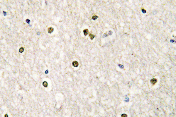 IHC of CRSP77 (V171) pAb in paraffin-embedded human brain tissue.