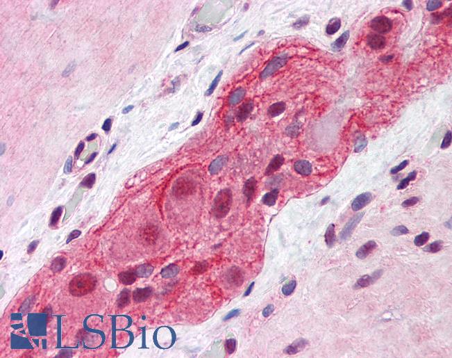 Anti-MED17 / TRAP80 antibody IHC of human small intestine, myenteric plexus. Immunohistochemistry of formalin-fixed, paraffin-embedded tissue after heat-induced antigen retrieval. Antibody LS-B6197 concentration 1.2 ug/ml.